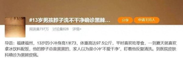 配资炒股炒股 脖子总是黑黑的洗不干净？别大意，这可能是身体在“求救”！